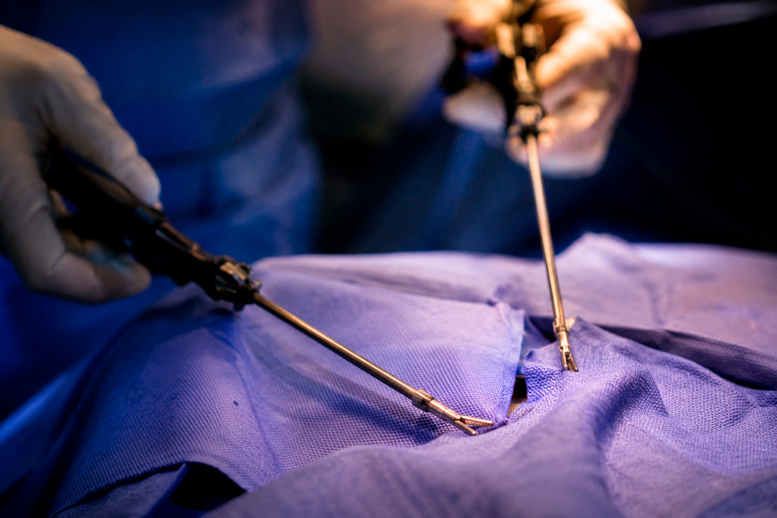 Cirugía laparoscópica de endometriosis